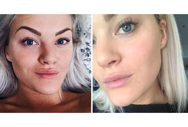 Lisa Anckarman: Jag fick längre fransar efter bara två veckor