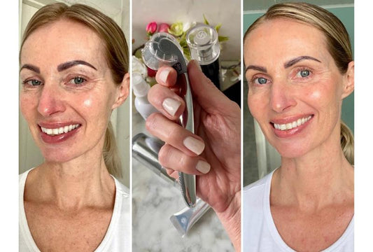 Netstyles chefredaktör Charlotta Flinkenberg har testat vår Skin Roller