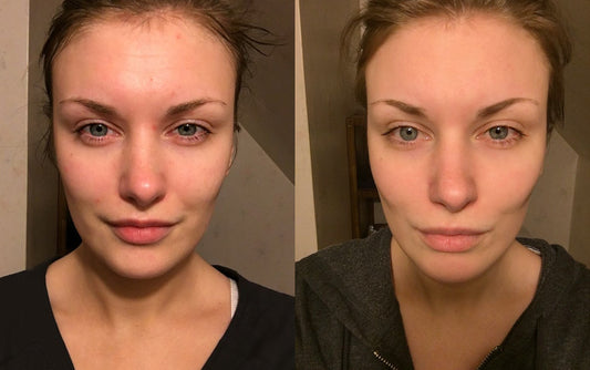 Makeupartisten: Ingen skönhetsprodukt jag testat någonsin har gett sådana här resultat!